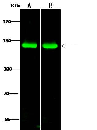 Western Blot: PKN1 Antibody [NBP2-98761] - Lane A: K562 Whole Cell LysateLane B: Jurkat Whole Cell LysateLysates/proteins at 30 ug per lane.SecondaryGoat Anti- Rabbit  IgG H&L (Dylight 800)  at 1/10000 dilution.Developed using the Odyssey technique.Performed under reducing conditions.Predicted band size:104 kDaObserved band size:125 kDa