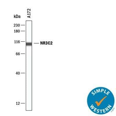Simple Western: Mineralocorticoid R/NR3C2 Antibody [NBP2-99010] - Simple Western lane view shows lysates of A172. A specific band was detected for Mineralocorticoid R/NR3C2 at approximately 107 kDa (as indicated) using 20 ug/mL of Mineralocorticoid R/NR3C2.