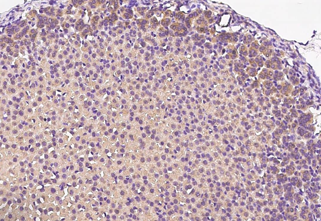 Immunohistochemistry-Paraffin DDRGK1 Antibody