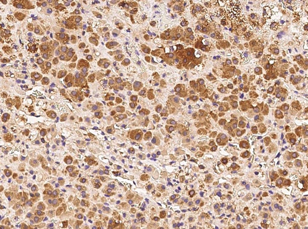 Immunohistochemistry-Paraffin DDRGK1 Antibody