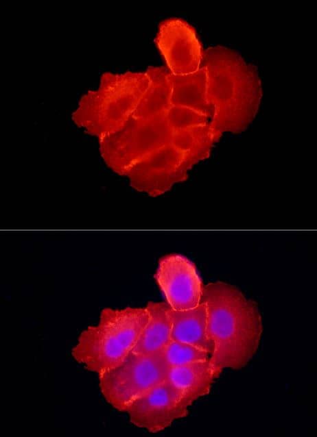 Immunocytochemistry/Immunofluorescence: EGFR Antibody [NBP3-03213] - Analysis of A-431 cells using EGFR Rabbit pAb at dilution of 1:300 (40x lens). Blue: DAPI for nuclear staining.