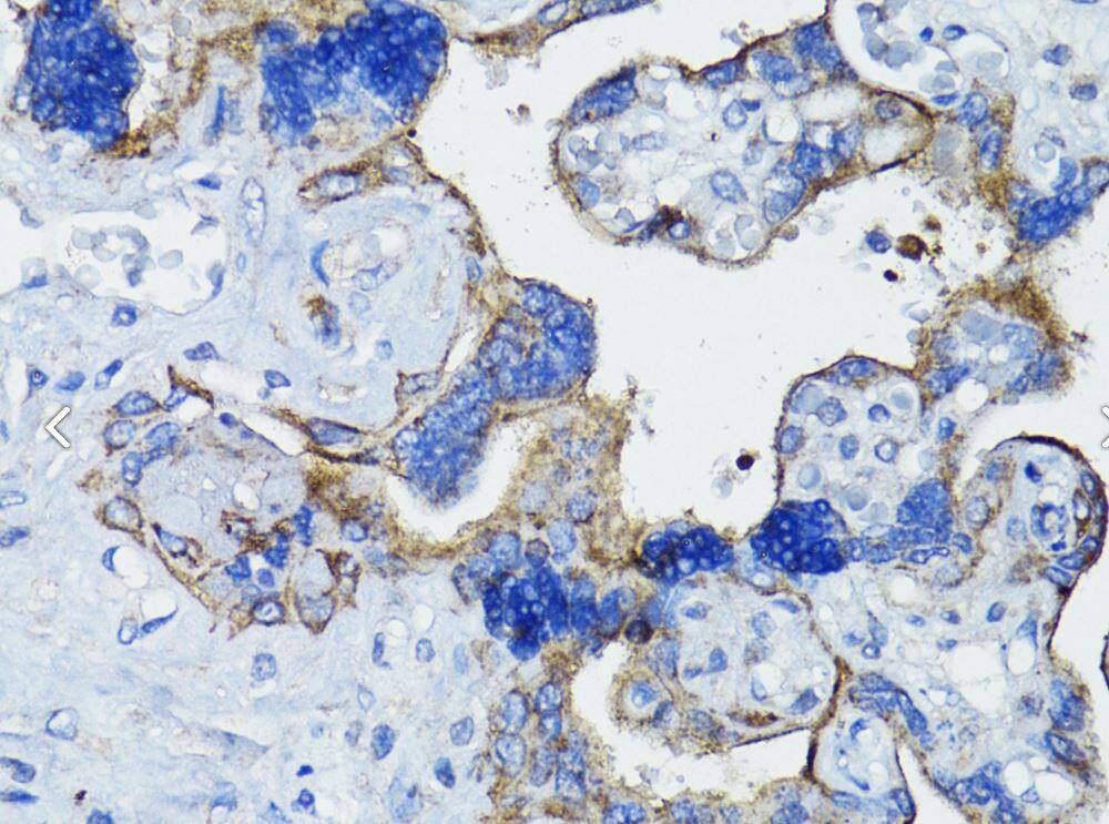 IHC-P-EGFR Antibody [NBP3-03213] -Human placenta using EGFR antibody at dilution of 1:200 (40x lens).Perform microwave antigen retrieval with 10 mM PBS buffer pH 7.2 before commencing with IHC staining protocol.