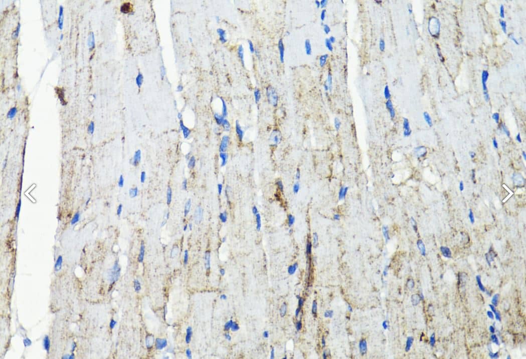 IHC-P-EGFR Antibody [NBP3-03213] - Mouse heart using EGFR antibody at dilution of 1:200 (40x lens).Perform microwave antigen retrieval with 10 mM PBS buffer pH 7.2 before commencing with IHC staining protocol.