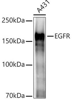 Western Blot: EGFR Antibody [NBP3-03213] - analysis of A431, using EGFR Rabbit pAb at 1:2000 dilution.Secondary antibody: HRP Goat Anti-Rabbit IgG (H+L) at 1:10000 dilution.Lysates/proteins: 25 ug per lane.Blocking buffer: 3% nonfat dry milk in TBST.Detection: ECL Basic Kit .Exposure time: 3s.