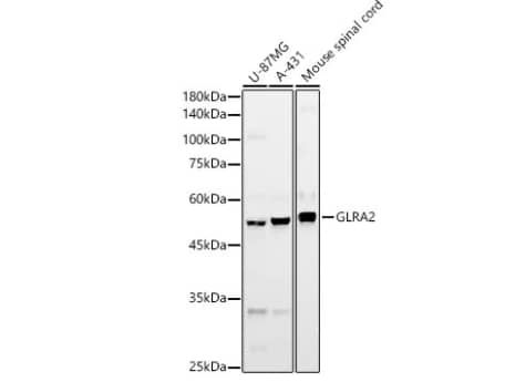 Western Blot Glycine Receptor alpha 2 Antibody - Azide and BSA Free