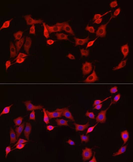 Immunocytochemistry/Immunofluorescence: Exostosin 1 Antibody [NBP3-03736] -Analysis of PC-12 cells using EXT1 Rabbit pAb at dilution of 1:100 (40x lens). Blue: DAPI for nuclear staining.