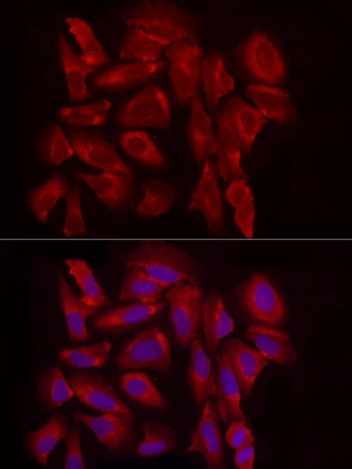 Immunocytochemistry/Immunofluorescence: Exostosin 1 Antibody [NBP3-03736] -Analysis of U2OS cells using EXT1 Rabbit pAb at dilution of 1:100 (40x lens). Blue: DAPI for nuclear staining.