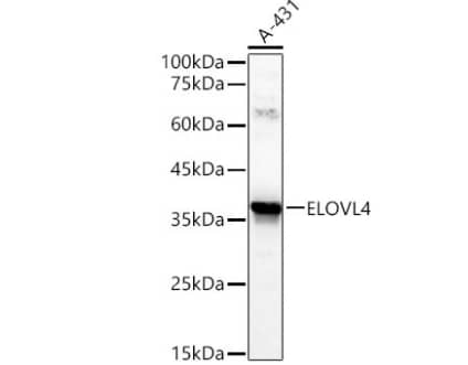 Western Blot: ELOVL4 Antibody [NBP3-03895] -analysis of lysates from A-431 cells using ELOVL4 Rabbit pAb at 1:600 dilution.Secondary antibody: HRP-conjugated Goat anti-Rabbit IgG (H+L) at 1:10000 dilution.Lysates/proteins: 25 μg per lane.Blocking buffer: 3% nonfat dry milk in TBST.Detection: ECL Basic Kit. Exposure time:30s.