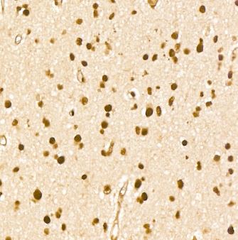 Immunohistochemistry-Paraffin: THRAP3 Antibody [NBP3-04324] -Human brain tissue using THRAP3 Rabbit pAb at a dilution of 1:100 (40x lens). High pressure antigen retrieval was performed with 0.01 M citrate buffer (pH 6.0) prior to IHC staining.
