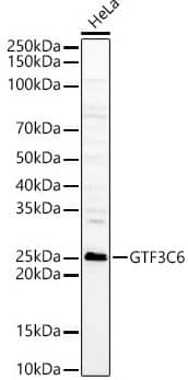 Western Blot: GTF3C6 Antibody [NBP3-04529] - analysis of various lysates, using GTF3C6 Rabbit pAb at 1:5000 dilution.Secondary antibody: HRP Goat Anti-Rabbit IgG (H+L) at 1:10000 dilution.Lysates/proteins: 25 ug per lane.Blocking buffer: 3% nonfat dry milk in TBST.Detection: ECL Basic Kit. Exposure time: 60s.