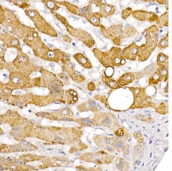 Immunohistochemistry-Paraffin: HSD17B13 Antibody [NBP3-04837] - Human liver using HSD17B13 Rabbit pAb at dilution of 1:100 (40x lens). High pressure antigen retrieval performed with 0.01M Citrate Buffer (pH 6.0) prior to IHC staining.