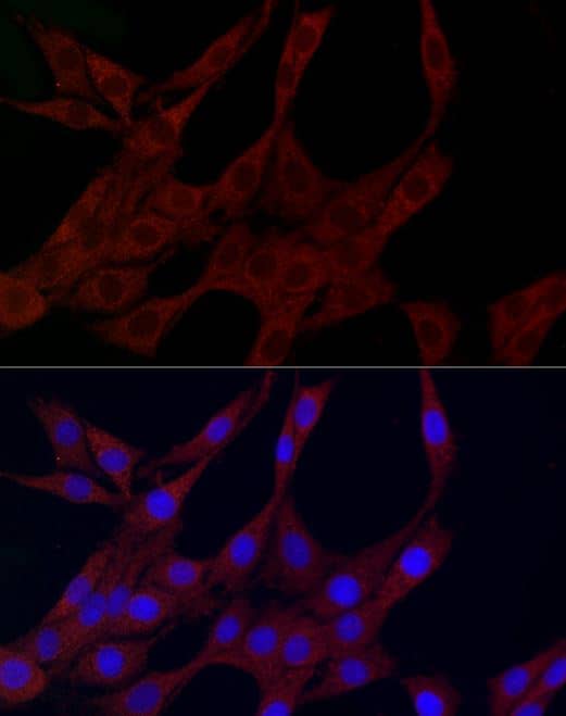 ICC/IF-NBP3-04961-PLK2 Antibody-Analysis of PC-12 cells using PLK2 Rabbit pAb at dilution of 1:100 (40x lens). Blue: DAPI for nuclear staining.