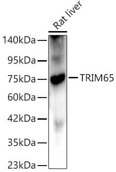 Western Blot-TRIM65 Antibody - Azide and BSA Free-NBP3-05002- analysis of lysates from Rat liver, using TRIM65 Rabbit pAb at 1:1000 dilution.Secondary antibody: HRP Goat Anti-Rabbit IgG (H+L) at 1:10000 dilution.Lysates/proteins: 25ug per lane. Blocking buffer: 3% nonfat dry milk in TBST.Detection: ECL Basic Kit. Exposure time: 180s.