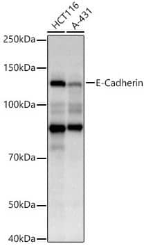 Western Blot: pan Cadherin Antibody (2M6G8) [NBP3-05342] - analysis of extracts of various cell lines, using E-Cadherin antibody at 1:700 dilution.Secondary antibody: HRP Goat Anti-Mouse IgG (H+L) at 1:10000 dilution.Lysates/proteins: 25 ug per lane.Blocking buffer: 3% nonfat dry milk in TBST.Detection: ECL Basic Kit.Exposure time: 10s.