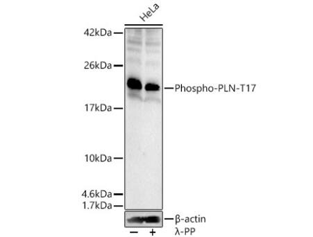 Western Blot: Phospholamban [p Thr17] Antibody [NBP3-05464] -Analysis of lysates from HeLa cells, using Phospho-PLN-T17 Rabbit pAb at 1:400 dilution. HeLa cells were treated by  lambda -PP mixed solution (1ul) at 30℃ for 30 minutes.Secondary antibody: HRP-conjugated Goat anti-Rabbit IgG (H+L)  at 1:10000 dilution.Lysates/proteins: 25μg per lane.Blocking buffer: 3% nonfat dry milk in TBST.Detection: ECL Enhanced Kit. Exposure time: 90s.