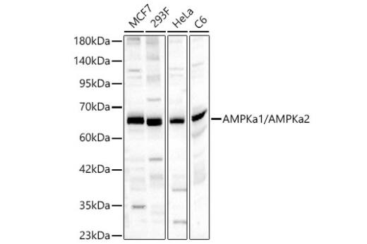 Western Blot: AMPK alpha 1/2 Antibody [NBP3-05628] -Analysis of various lysates, using AMPKa1/AMPKa2 Rabbit pAb at 1:1000 dilution.Secondary antibody: HRP-conjugated Goat anti-Rabbit IgG (H+L) at 1:10000 dilution.Lysates/proteins: 25μg per lane.Blocking buffer: 3% nonfat dry milk in TBST.Detection: ECL Basic Kit. Exposure time: 45s.