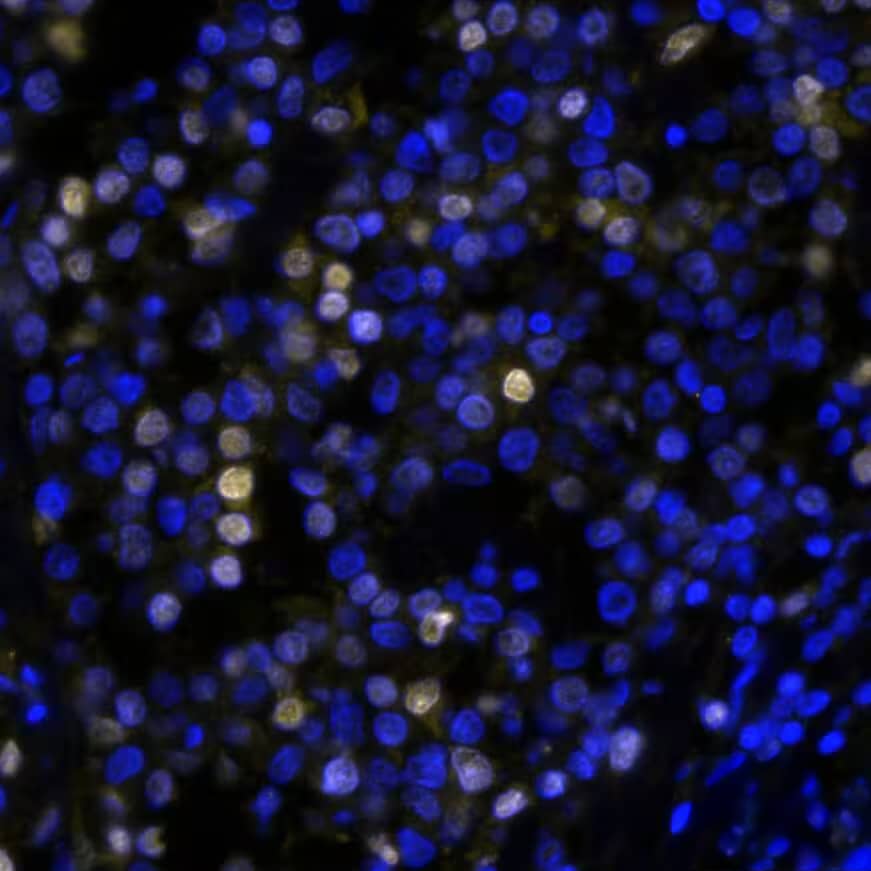 IRF4 was detected in immersion fixed paraffin-embedded sections of human Hodgkin's Lymphoma using Rabbit Anti-Human IRF4, Monoclonal Antibody at 10ug/mL at 37°Celsius for 4 minutes. Before incubation with the primary antibody, tissue underwent an all-in-one dewaxing and antigen retrieval preprocessing using PreTreatment Module (PT Module) and Dewax and HIER Buffer H (pH 9; Epredia Catalog # TA-999-DHBH). Tissue was stained using the Alexa Fluor™ Plus 647 Goat anti-Rabbit IgG Secondary Antibody at 1:200 at 37°Celsius for 2 minutes. (Yellow; Lunaphore Catalog # DR647RB) and counterstained with DAPI (blue; Lunaphore Catalog # DR100). Specific staining was localized to the nucleus. Protocol available in COMET™ Panel Builder.