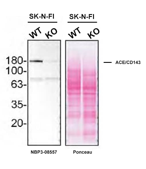 Western blot shows lysates of SK-N-FI and ACE/CD143 knockout SK-N-FI cell line (KO). Nitrocellulose membrane was probed with ACE/CD143 Antibody (Catalog # NBP3-08557) O/N at 4C, followed by HRP-conjugated Secondary Antibody and ECL detection. A specific band was detected for ACE/CD143 (as indicated) in the parental SK-N-FI cell line, but is not detectable in knockout SK-N-FI cell line. Primary antibody dilution used: 1/500. The Ponceau stained transfers of each blot are shown. Image, protocol and testing courtesy of YCharOS Inc. (ycharos.com).