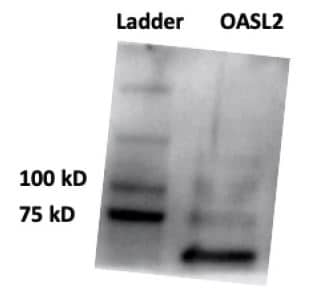 Western Blot OASL2 Antibody