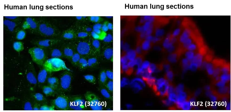 Human lung epithelial cell