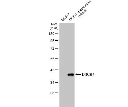 Western Blot: DHCR7 Antibody [NBP3-12940] -MCF-7 whole cell and membrane extracts (30 μg) were separated by 10% SDS-PAGE, and the membrane was blotted with DHCR7 antibody diluted at 1:1000. The HRP-conjugated anti-rabbit IgG antibody (NBP2-19301) was used to detect the primary antibody.