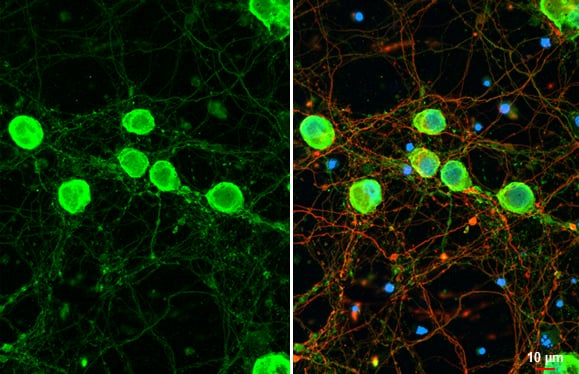 Nectin 1 antibody detects Nectin 1 protein at cell membrane by immunofluorescent analysis.Sample: DIV9 rat E18 primary cortical neuron cells were fixed in 4% paraformaldehyde at RT for 15 min.Green: Nectin 1 stained by Nectin 1 antibody diluted at 1:250.Red: Tau, an axon marker, stained by Tau antibody [287]  diluted at 1:500.Blue: Fluoroshield with DAPI. 