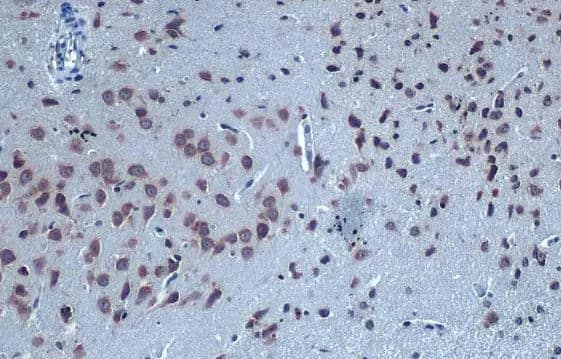 Immunohistochemistry-Paraffin-GABA-AR alpha 6 Antibody-NBP3-12973-Rat brain.GABA A Receptor alpha 6 stained by GABA A Receptor alpha 6 antibody diluted at 1:500.Antigen Retrieval: Citrate buffer, pH 6.0, 15 min.