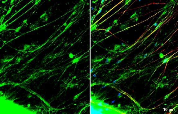 Immunocytochemistry/Immunofluorescence: CGRP Antibody [NBP3-13330] -Mouse dorsal root ganglia cells were fixed in 4% paraformaldehyde at RT for 15 min.Green: CGRP stained by CGRP antibody diluted at 1:500.Red: NF-H, a axon marker, stained by NF-H antibody [114] diluted at 1:500.Blue: Fluoroshield with DAPI. 