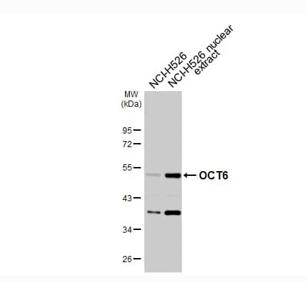 NCI-H526 whole cell and nuclear extracts (30 μg) were separated by 10% SDS-PAGE, and the membrane was blotted with OCT6 antibody diluted at 1:1000. The HRP-conjugated anti-rabbit IgG antibody was used to detect the primary antibody.