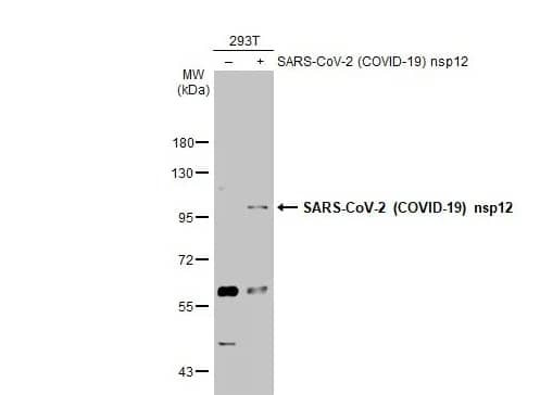 Western Blot: SARS-CoV-2 nsp12 Antibody [NBP3-13456] -Non-transfected (–) and transfected (+) 293T whole cell extracts (30 μg) were separated by 7.5% SDS-PAGE, and the membrane was blotted with SARS-CoV-2 (COVID-19) nsp12 antibody diluted at 1:5000. The HRP-conjugated anti-rabbit IgG antibody (NBP2-19301 was used to detect the primary antibody.