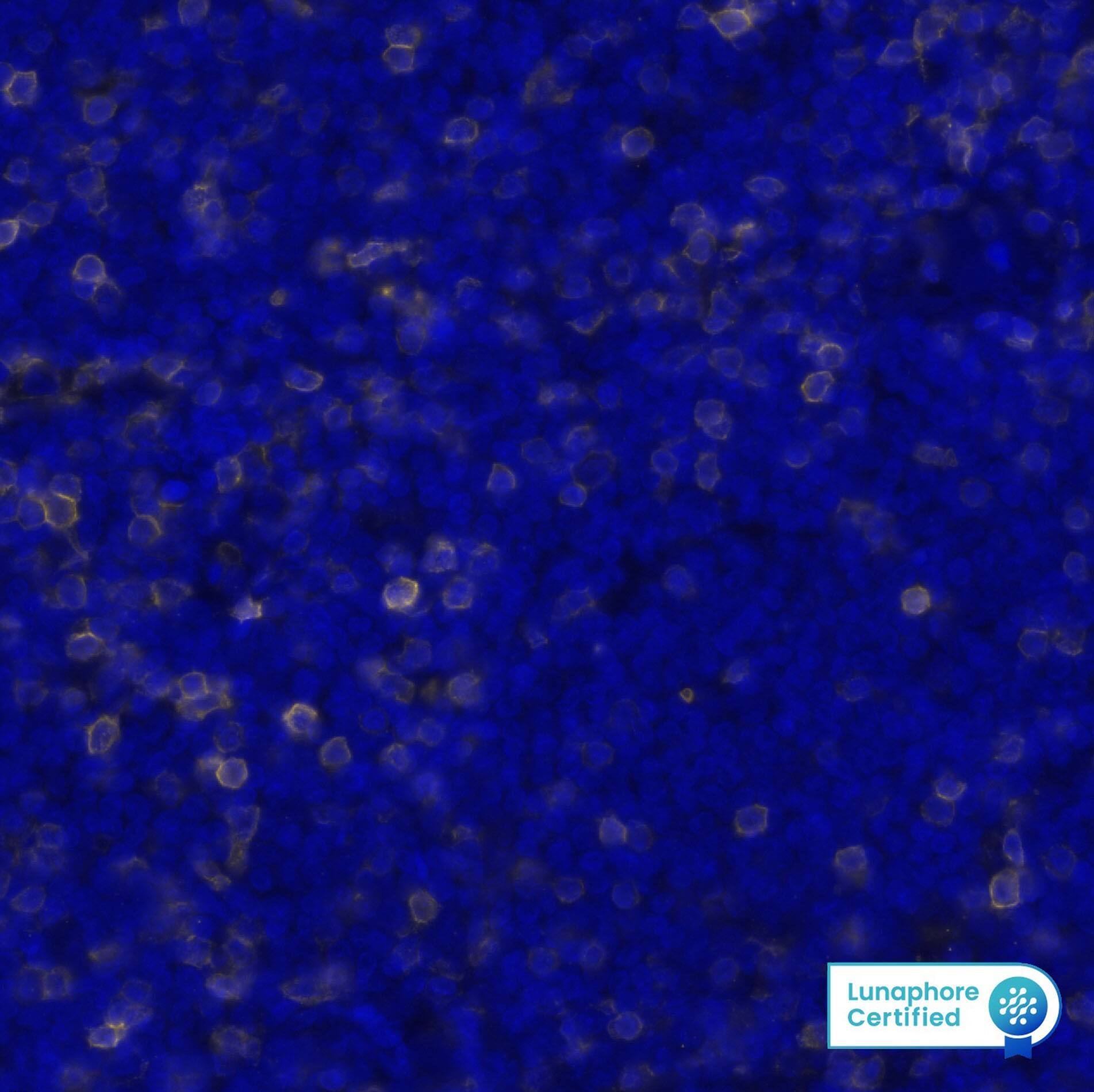CD5 was detected in immersion fixed paraffin-embedded sections of human mantle cell lymphoma using Mouse Anti-Human CD5 Monoclonal Antibody (Catalog # NBP3-15133) at 1:50 at 37 ° Celsius for 4 minutes. Before incubation with the primary antibody, tissue underwent an all-in-one dewaxing and antigen retrieval preprocessing using PreTreatment Module (PT Module) and Dewax and HIER Buffer H (pH 9; Epredia Catalog # TA-999-DHBH). Tissue was stained using the Alexa Fluor™ 647 Goat anti-Mouse IgG Secondary Antibody at 1:200 at 37 ° Celsius for 2 minutes. (Yellow; Lunaphore Catalog # DR647MS) and counterstained with DAPI (blue; Lunaphore Catalog # DR100). Specific staining was localized to the cell membrane. Protocol available in COMET™ Panel Builder.
