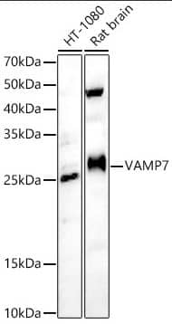 Western Blot: VAMP-7 Antibody [NBP3-15595] - analysis of various lysates, using VAMP7 antibody at 1:500 dilution.Secondary antibody: HRP Goat Anti-Rabbit IgG (H+L) at 1:10000 dilution.Lysates/proteins: 25ug per lane.Blocking buffer: 3% nonfat dry milk in TBST.Detection: ECL Enhanced Kit.Exposure time: 60s.