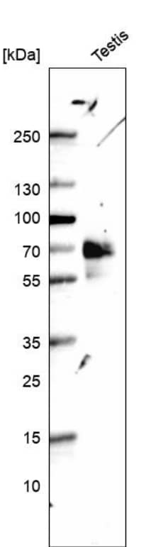  Analysis in human testis tissue.