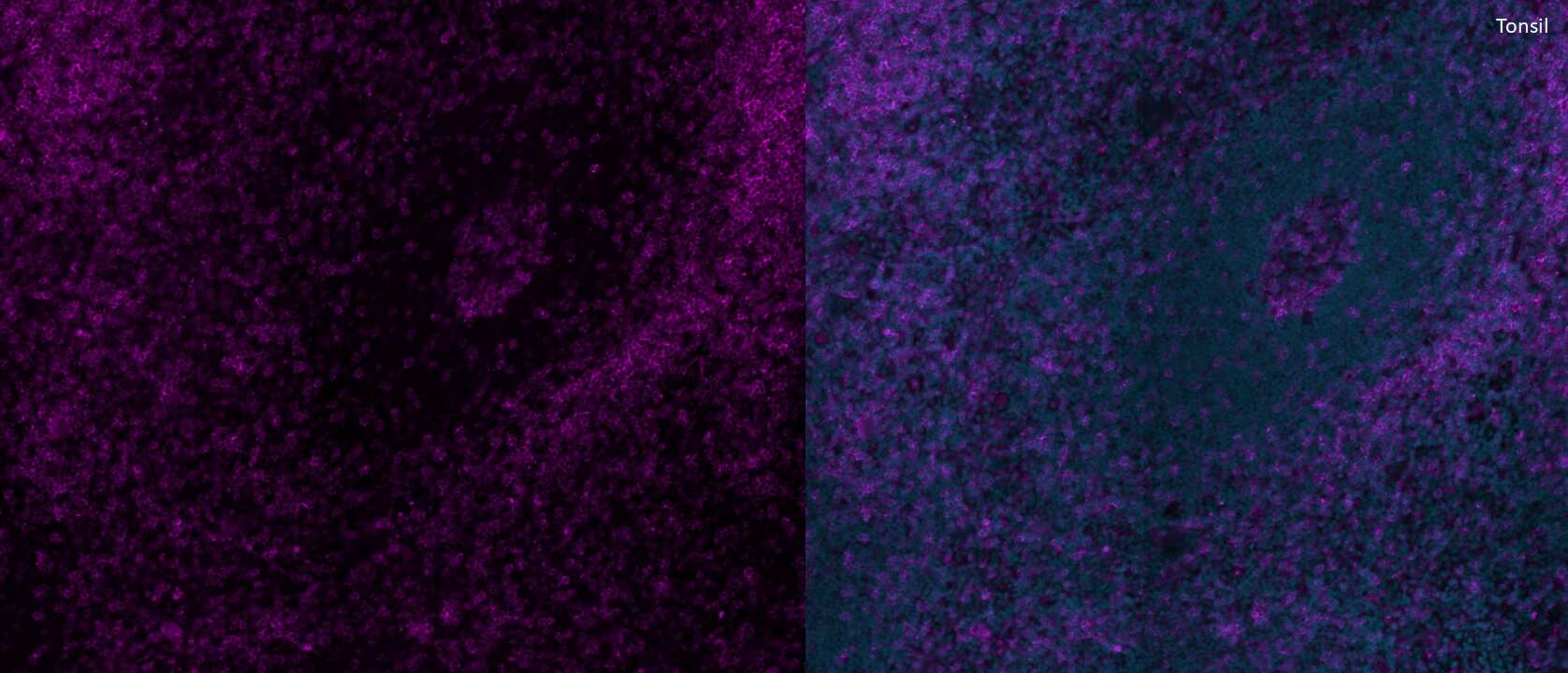 Immunohistochemistry-Paraffin: Rabbit CD4 pAb [NBP3-18057] - Immunofluorescence staining of human tonsil FFPE tissue. Antibody diluted 1:50 (Catalog # NBP3-18057AF647) in 3% BSA and incubated over night at 4 °C. Heat mediated antigen retrieval at pH 9. Image from a verified customer review.