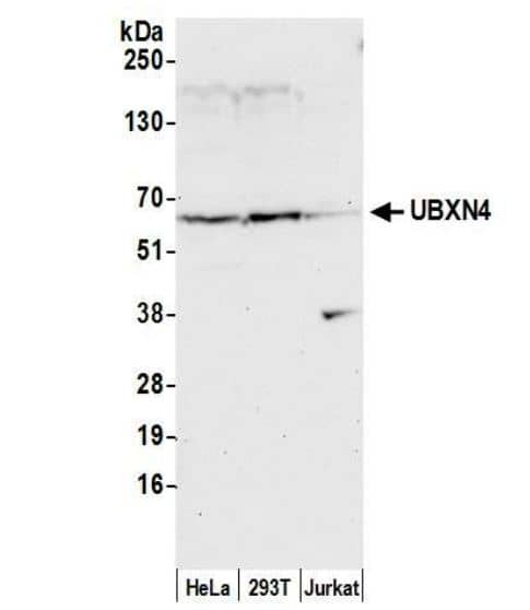 Western Blot-UBXD2 Antibody-NBP3-18404- Whole cell lysate (50 ug) from HeLa, HEK293T, and Jurkat cells prepared using NETN lysis buffer. Antibody: Affinity purified rabbit anti-UBXN4 antibody used for WB at 0.1 mg/ml. Detection: Chemiluminescence with an exposure time of 30 seconds.