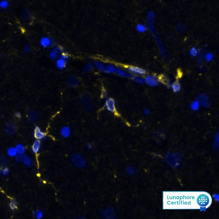 STING/TMEM173 was detected in immersion fixed paraffin-embedded sections of human brain Cortex (Cerebrum) using Rabbit Anti-Human STING/TMEM173, Monoclonal Antibody (Catalog #NBP3-18816) at 10ug/mL at 37 ° Celsius for 4 minutes. Before incubation with the primary antibody, tissue underwent an all-in-one dewaxing and antigen retrieval preprocessing using PreTreatment Module (PT Module) and Dewax and HIER Buffer H (pH 9; Epredia Catalog # TA-999-DHBH). Tissue was stained using the Alexa Fluor™ Plus 647 Goat anti-Rabbit IgG Secondary Antibody at 1:200 at 37 ° Celsius for 2 minutes. (Yellow; Lunaphore Catalog # DR647RB) and counterstained with DAPI (blue; Lunaphore Catalog # DR100). Specific staining was localized to the membrane. Protocol available in COMET™ Panel Builder.The image is attached.