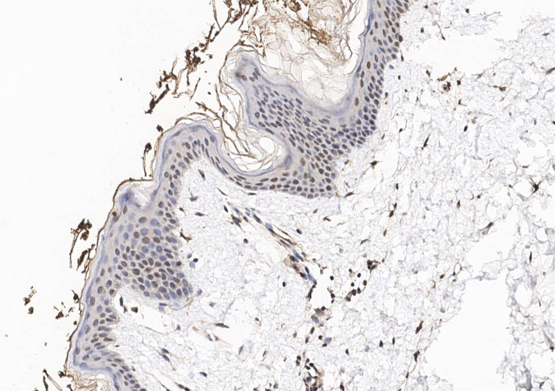 Immunohistochemistry-Paraffin-Nucleoporin 107 Antibody-NBP3-18854-Staining of human NUP107 in human skin with rabbit polyclonal antibody at 1:100 dilution.