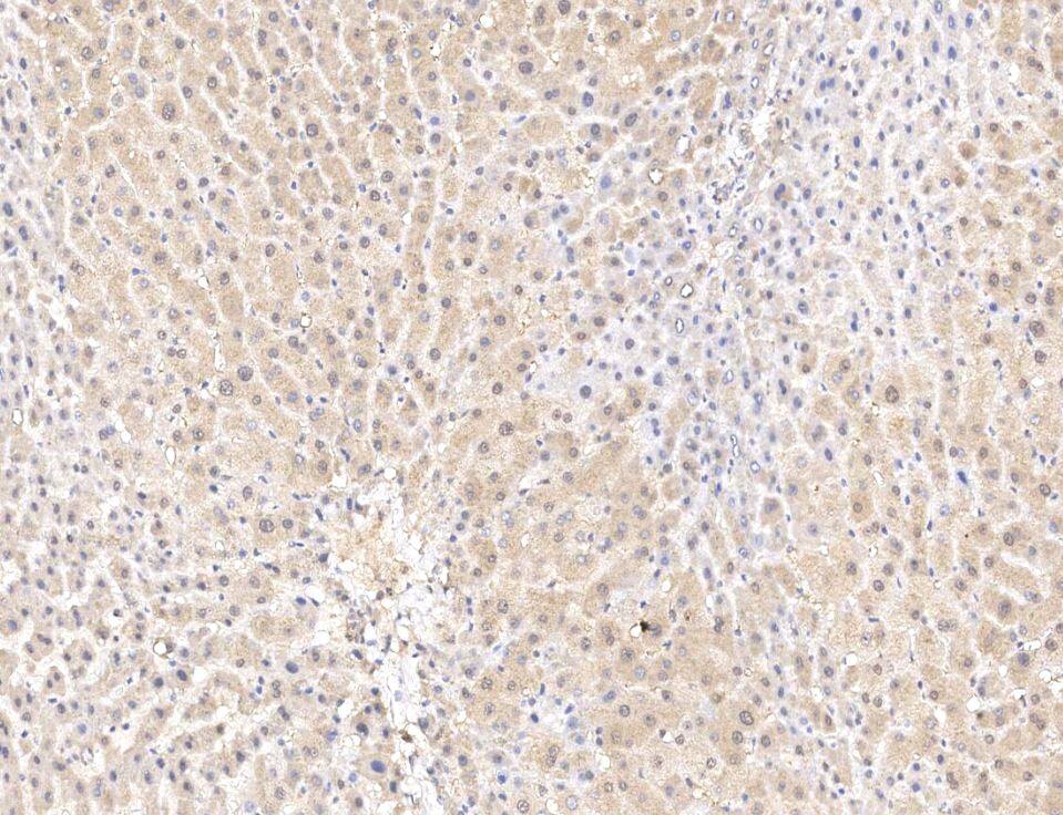Immunohistochemistry-Paraffin-NBP3-18859-RNF25 Antibody-Staining of human RNF25 in human liver with rabbit polyclonal antibody at 1:100 dilution.