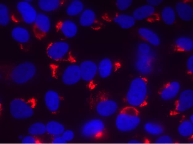 Immunocytochemistry/ Immunofluorescence: Rabbit dsRNA mAb (1D3) - Chimeric - Azide and BSA Free [NBP3-20111] - Immunofluorescence analysis of paraformaldehyde-fixed, triton-permeabilized cells infected with Dengue 2 virus stained with the chimeric rabbit IgG version of 1D3 (Ab00460-23.0) at 1/300 followed by Alexa 568 secondary antibody (red). The image is courtesy of Cecilia Alejandra Vazquez (IQUIBICEN (UBA-CONICET)).