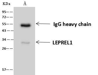 Immunoprecipitation-NBP3-20222-LEPREL1 Antibody-Lane A:0.5 mg U-251 MG Whole Cell Lysate4 uL anti-LEPREL1 rabbit polyclonal antibody and 60 ug of Immunomagnetic beads Protein A/G.Primary antibody:Anti-LEPREL1 rabbit polyclonal antibody,at 1:100 dilutionSecondary antibody:Goat Anti-Rabbit IgG (H+L)/HRP at 1/10000 dilutionDeveloped using the ECL technique.Performed under reducing conditions.Predicted band size: 30 kDaObserved band size :30 kDa