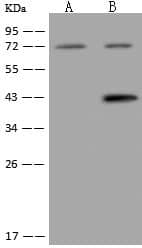 Western Blot-NBP3-20225-KIAA1958 Antibody-Lane A: HeLa Whole Cell LysateLane B: U-251 MG Whole Cell LysateLysates/proteins at 30 ug per lane.SecondaryGoat Anti-Rabbit IgG (H+L)/HRP at 1/10000 dilution.Developed using the ECL technique.Performed under reducing conditions.Predicted band size:79 kDa