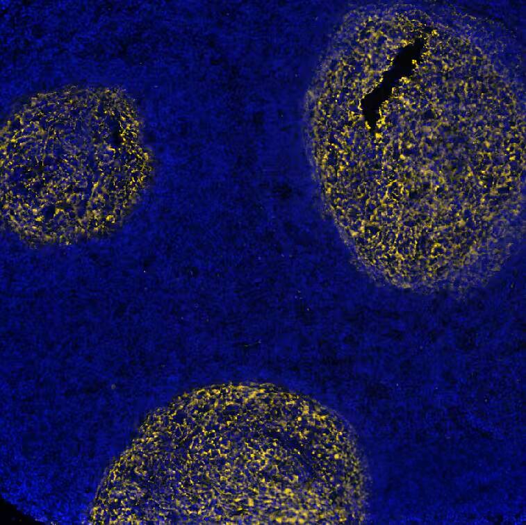 CD21 was detected in immersion fixed paraffin-embedded sections of human Lymph Node using Rabbit Anti-Human CD21, Monoclonal Antibody (Catalog # NBP3-20354) at 1:2000 at 37° Celsius for 4 minutes. Before incubation with the primary antibody, tissue underwent an all-in-one dewaxing and antigen retrieval preprocessing using PreTreatment Module (PT Module) and Dewax and HIER Buffer H (pH 9; Epredia Catalog #TA-999-DHBH).Tissue was stained using the Alexa Fluor™ Plus 555 Goat anti-Rabbit IgG Secondary Antibody at 1:100 at 37 ° Celsius for 2 minutes. (Yellow; Lunaphore Catalog # DR555RB) and counterstained with DAPI (blue; Lunaphore Catalog # DR100). Specific staining was localized to the membrane. Protocol available in COMET™ Panel Builder. 