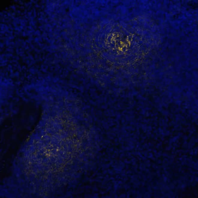 CD21 was detected in immersion fixed paraffin-embedded sections of human Spleen using Mouse Anti-Human CD21, Monoclonal Antibody (Catalog # NBP3-26866) at 1:800 at 37° Celsius for 4 minutes. Before incubation with the primary antibody, tissue underwent an all-in-one dewaxing and antigen retrieval preprocessing using PreTreatment Module (PT Module)and Dewax and HIER Buffer H (pH 9; Epredia Catalog #TA-999-DHBH). Tissue was stained using the Alexa Fluor™ 647 Goat anti-Mouse IgG Secondary Antibody at 1:200 at 37 ° Celsius for 2 minutes. (Yellow; Lunaphore Catalog # DR647MS) and counterstained with DAPI (blue; Lunaphore Catalog # DR100). Specific staining was localized to the membrane. Protocol available in COMET™ Panel Builder.