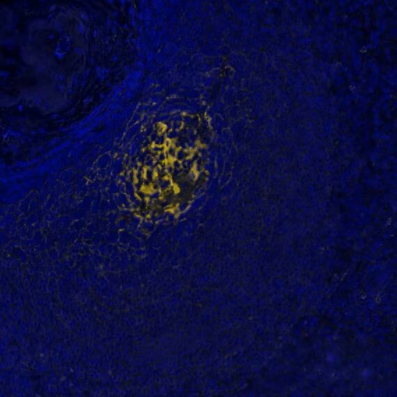 CD21 was detected in immersion fixed paraffin-embedded sections of human Spleen using Rabbit Anti-Human CD21, Monoclonal Antibody (Catalog # NBP3-20354) at 1:2000 at 37° Celsius for 4 minutes. Before incubation with the primary antibody, tissue underwent an all-in-one dewaxing and antigen retrieval preprocessing using PreTreatment Module (PT Module) and Dewax and HIER Buffer H (pH 9; Epredia Catalog #TA-999-DHBH).Tissue was stained using the Alexa Fluor™ Plus 555 Goat anti-Rabbit IgG Secondary Antibody at 1:100 at 37 ° Celsius for 2 minutes. (Yellow; Lunaphore Catalog # DR555RB) and counterstained with DAPI (blue; Lunaphore Catalog # DR100). Specific staining was localized to the membrane. Protocol available in COMET™ Panel Builder. 