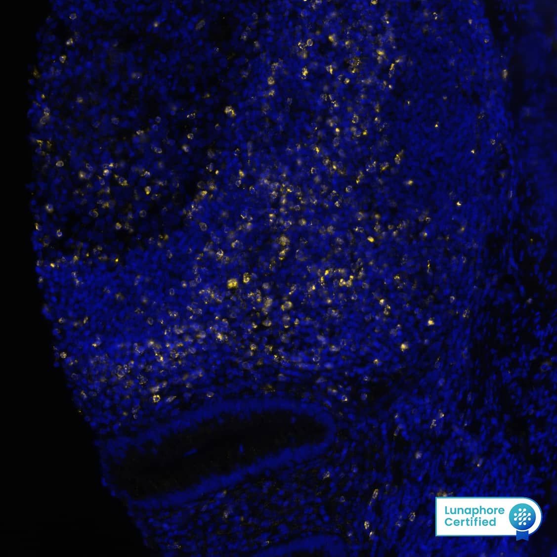 CTLA4 was detected in immersion fixed paraffin-embedded sections of human Appendix using Rabbit Anti-Human CTLA4, Monoclonal Antibody (Catalog # NBP3-20446 ) at 1:100 at 37° Celsius for 4 minutes. Before incubation with the primary antibody, tissue underwent an all-in-one dewaxing and antigen retrieval preprocessing using PreTreatment Module (PT Module)and Dewax and HIER Buffer H (pH 9; Epredia Catalog #TA-999-DHBH). Tissue was stained using the Alexa Fluor™ Plus 647 Goat anti-Rabbit IgG Secondary Antibody at 1:200 at 37 ° Celsius for 2 minutes. (Yellow; Lunaphore Catalog # DR647RB) and counterstained with DAPI (blue; Lunaphore Catalog # DR100). Specific staining was localized to the membrane. Protocol available in COMET™ Panel Builder.