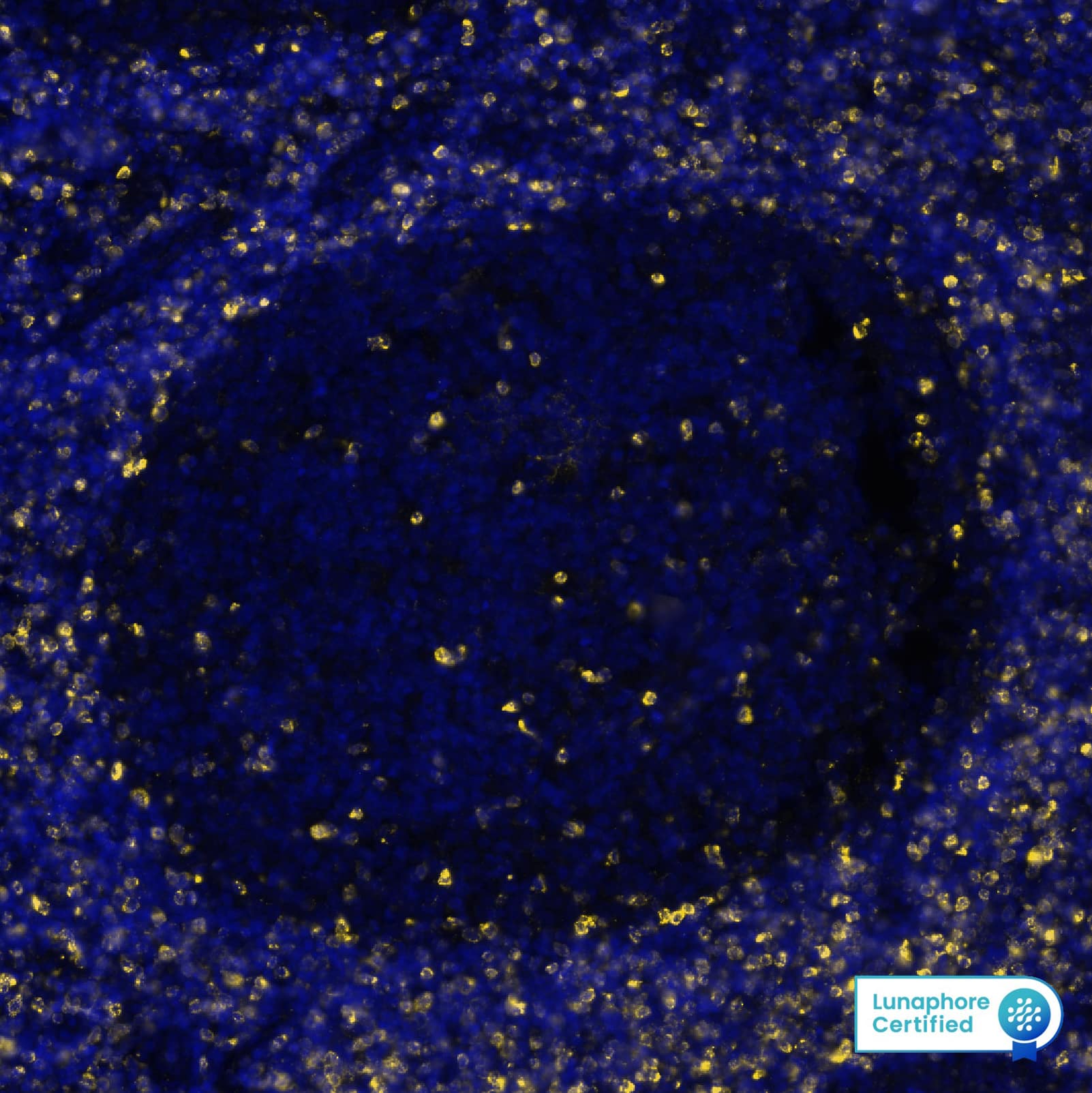 CTLA4 was detected in immersion fixed paraffin-embedded sections of human Hodgkin's Lymphoma using Rabbit Anti-Human CTLA4, Monoclonal Antibody (Catalog # NBP3-20446 ) at 1:100 at 37° Celsius for 4 minutes. Before incubation with the primary antibody, tissue underwent an all-in-one dewaxing and antigen retrieval preprocessing using PreTreatment Module (PT Module)and Dewax and HIER Buffer H (pH 9; Epredia Catalog #TA-999-DHBH). Tissue was stained using the Alexa Fluor™ Plus 647 Goat anti-Rabbit IgG Secondary Antibody at 1:200 at 37 ° Celsius for 2 minutes. (Yellow; Lunaphore Catalog # DR647RB) and counterstained with DAPI (blue; Lunaphore Catalog # DR100). Specific staining was localized to the membrane. Protocol available in COMET™ Panel Builder.