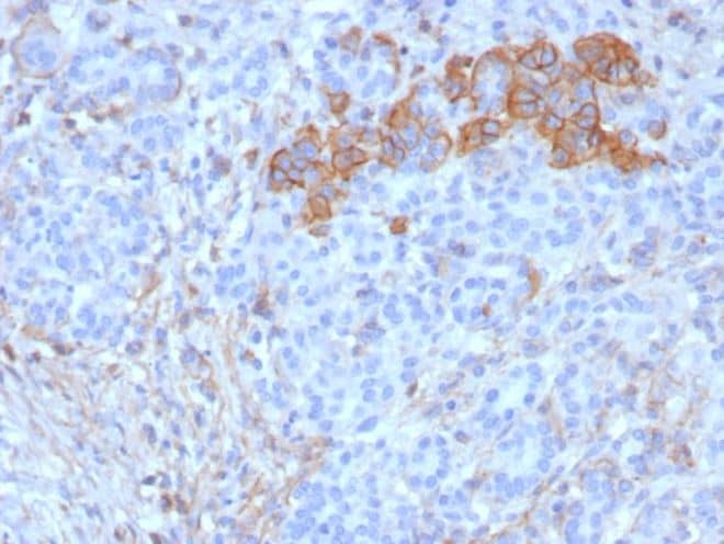 Immunohistochemistry-Paraffin: CD99 Antibody (rMIC2/6939) [NBP3-20478] - Formalin-fixed, paraffin-embedded human pancreas stained with CD99 antibody (rMIC2/6939). HIER: Tris/EDTA, pH9.0, 45min. Secondary: HRP-polymer, 30min. DAB, 5min.