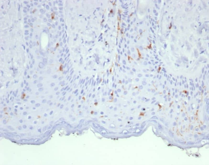Immunohistochemistry-Paraffin: Langerin/CD207 Antibody (LGRN/7430) [NBP3-20556] - Formalin-fixed, paraffin-embedded human skin stained with Langerin/CD207 antibody (LGRN/7430). HIER: Tris/EDTA, pH9.0, 45min. Secondary: HRP-polymer, 30min. DAB, 5min.