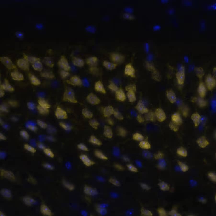 RBFOX3 was detected in immersion fixed paraffin-embedded sections of mouse Brain Cortex using Anti-Mouse RBFOX3, Monoclonal Antibody (Catalog #NBP3-21203) at 1:1000 dilution at 37 ° Celsius for 4 minutes. Before incubation with the primary antibody, tissue underwent an all-in-one dewaxing and antigen retrieval preprocessing using PreTreatment Module (PT Module) and Dewax and HIER Buffer H (pH 9; Epredia Catalog # TA-999-DHBH). Tissue was stained using the Alexa Fluor™ 647 Goat anti-Mouse IgG Secondary Antibody at 1:200 at 37 ° Celsius for 2 minutes. (Yellow; Lunaphore Catalog # DR647MS) and counterstained with DAPI (blue; Lunaphore Catalog # DR100). Specific staining was localized to the neuronal nuclei. Protocol available in COMET™ Panel Builder.