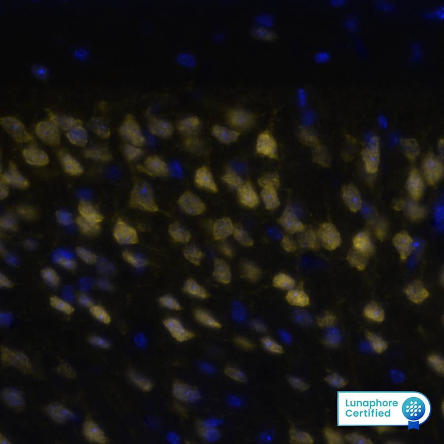 RBFOX3 was detected in immersion fixed paraffin-embedded sections of mouse Brain Cortex using Anti-Mouse RBFOX3, Monoclonal Antibody (Catalog #NBP3-21203) at 1:1000 dilution at 37 ° Celsius for 4 minutes. Before incubation with the primary antibody, tissue underwent an all-in-one dewaxing and antigen retrieval preprocessing using PreTreatment Module (PT Module) and Dewax and HIER Buffer H (pH 9; Epredia Catalog # TA-999-DHBH). Tissue was stained using the Alexa Fluor™ 647 Goat anti-Mouse IgG Secondary Antibody at 1:200 at 37 ° Celsius for 2 minutes. (Yellow; Lunaphore Catalog # DR647MS) and counterstained with DAPI (blue; Lunaphore Catalog # DR100). Specific staining was localized to the neuronal nuclei. Protocol available in COMET™ Panel Builder.